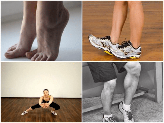 venat me variçe shkaktojnë dhimbje në këmbë