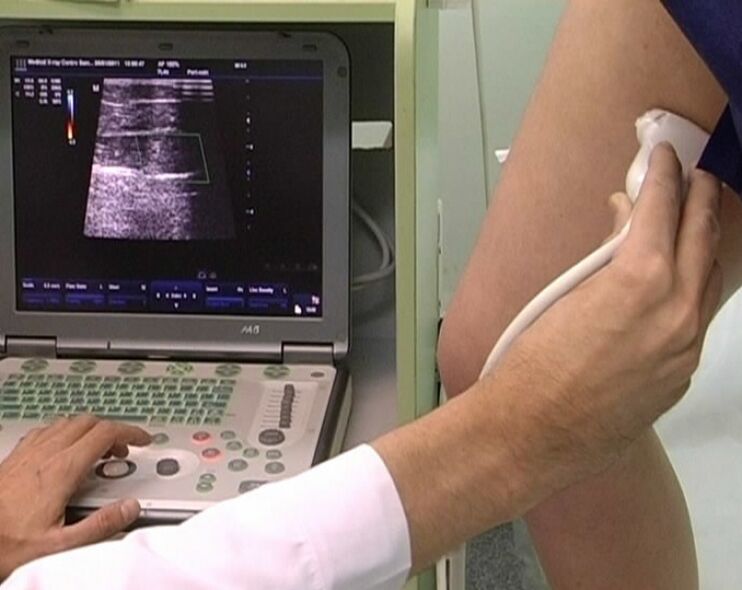 Diagnoza me ultratinguj e venave me variçe të legenit