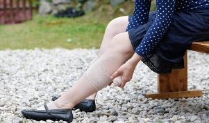 simptomat e venave me variçe në këmbë tek gratë